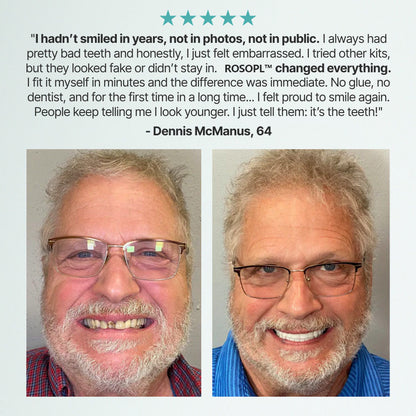 🌎Ends Today: 70% OFF! Custom-Fit Full Functional Dentures Make you more confident✨