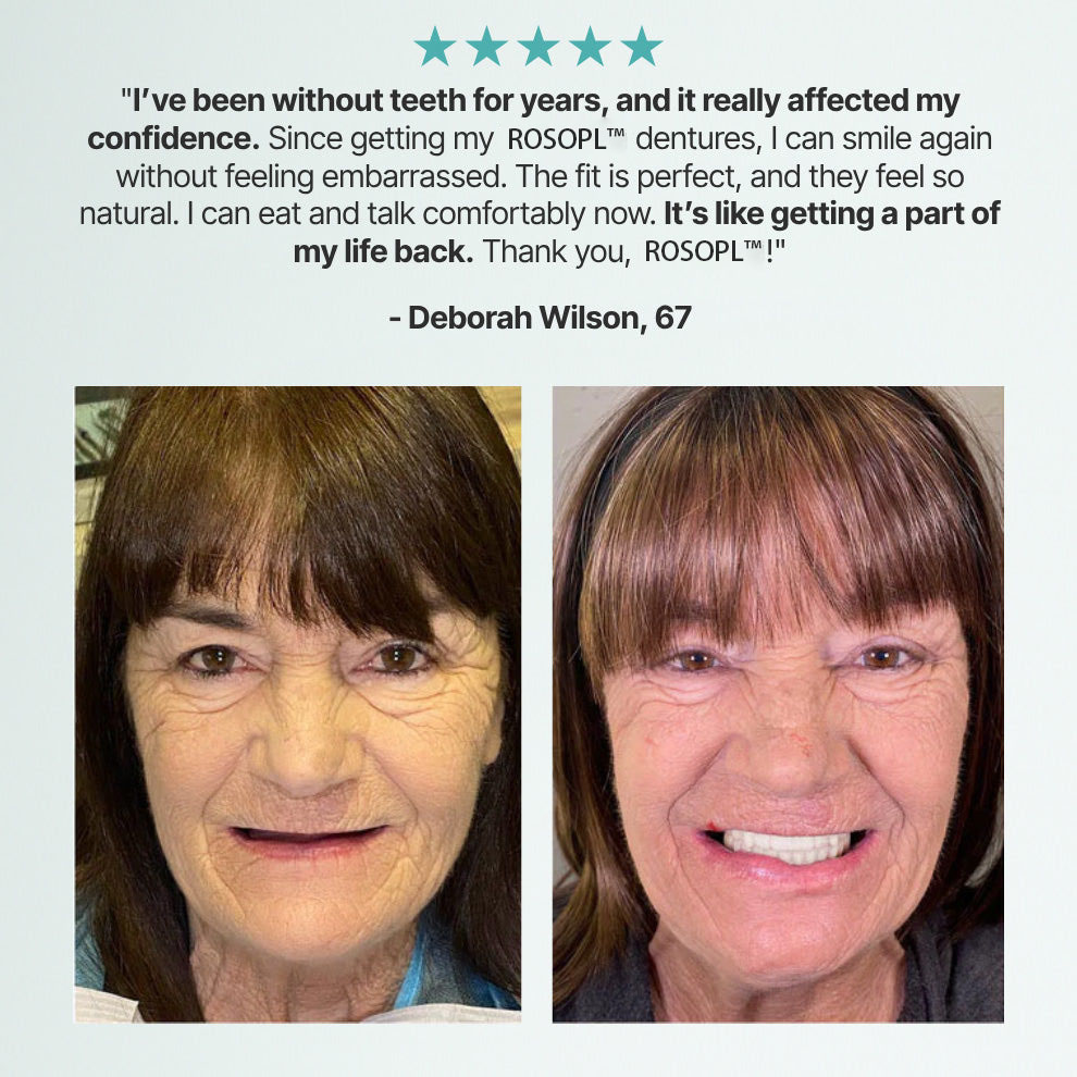 🌎Ends Today: 70% OFF! Custom-Fit Full Functional Dentures Make you more confident✨